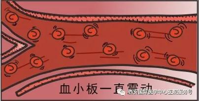 【科普】血小板是正常值的三倍？專家提醒小心血栓和出血！
