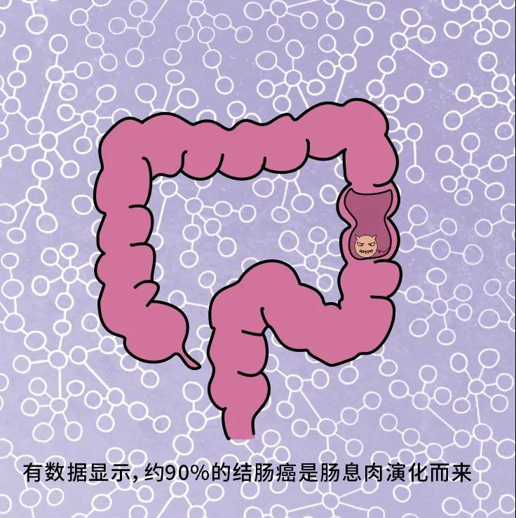 奪走“黑豹”生命的結(jié)腸癌，到底什么來頭？