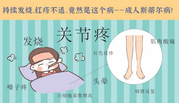 持續(xù)發(fā)燒、紅疹不退……她終于在這里治好了這個罕見病