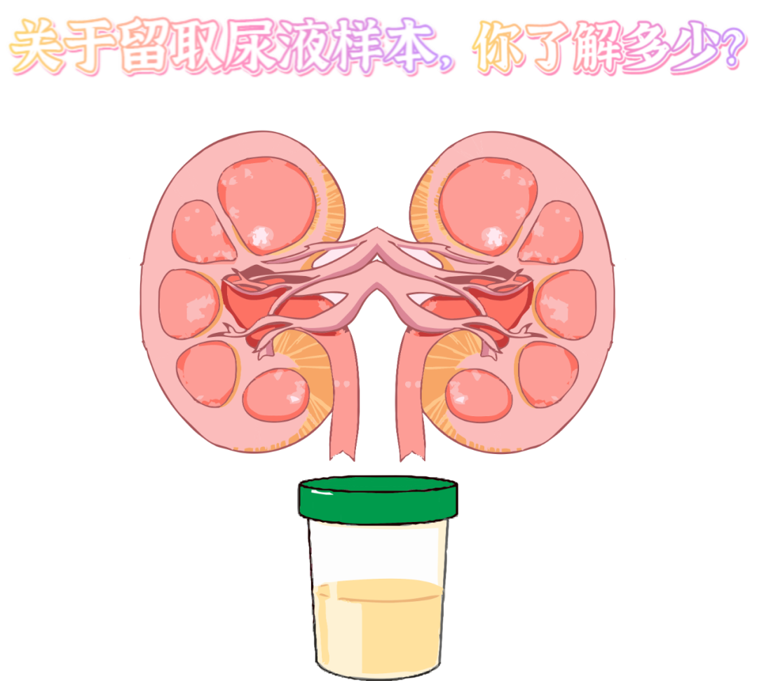 做尿檢，不得不說的注意事項！