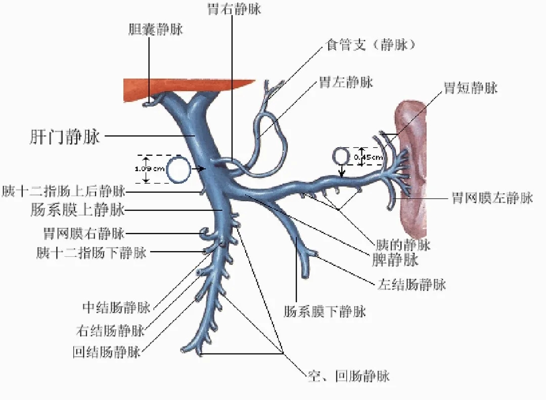 反復(fù)嘔血、黑便怎么辦？TIPS手術(shù)能解決