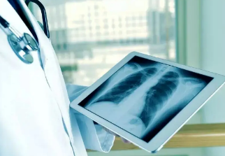 健康呼吸④體檢發(fā)現(xiàn)肺結(jié)節(jié)，我該怎么辦？