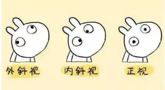 小baby老歪著頭？警惕斜頸! 這樣糾正……