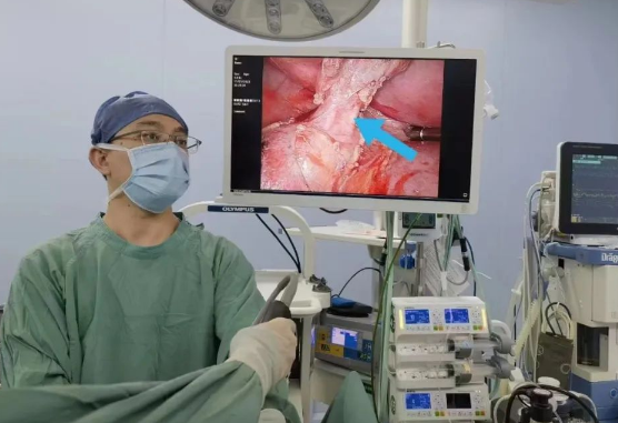 30歲小伙持續(xù)發(fā)燒咳嗽，原來是多長(zhǎng)一塊肺......