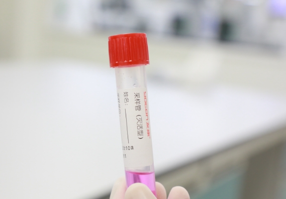 支原體感染檢測(cè)手段知多少？