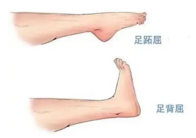 扭胯小連步、動(dòng)感搖花手……“科目三”雖火，運(yùn)動(dòng)損傷也要防！