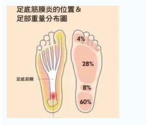每年新生數百萬足底筋膜炎患者！國際醫(yī)學專家提醒：跑步要選擇合適的鞋